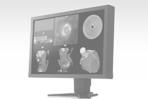 [Photo] SYNAPSE/VINCENT edical Imaging System