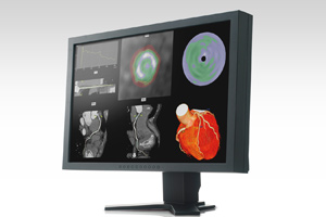 [Photo] SYNAPSE/VINCENT edical Imaging System